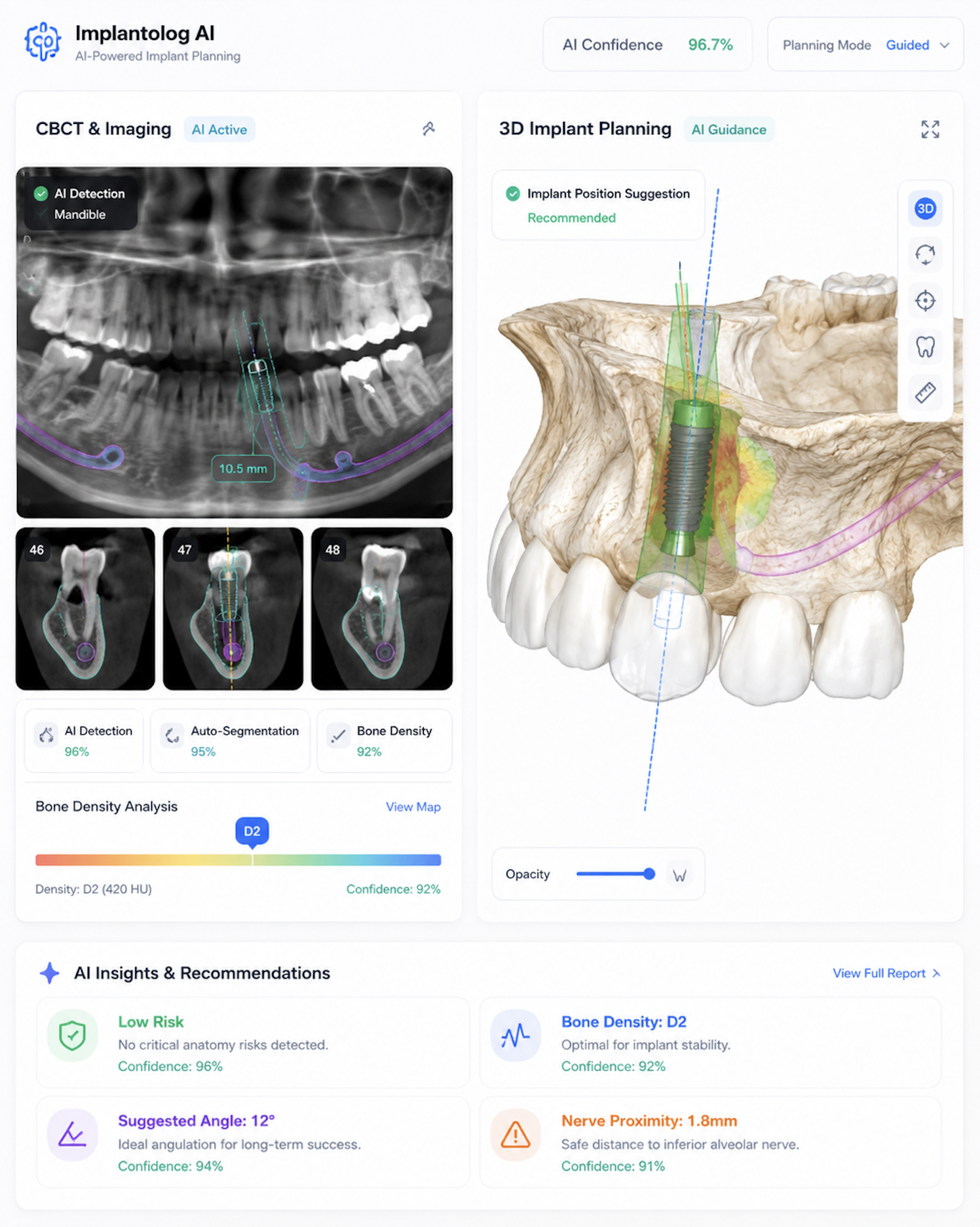 Implantology AI dashboard with CBCT imaging, 3D implant planning, and AI recommendations